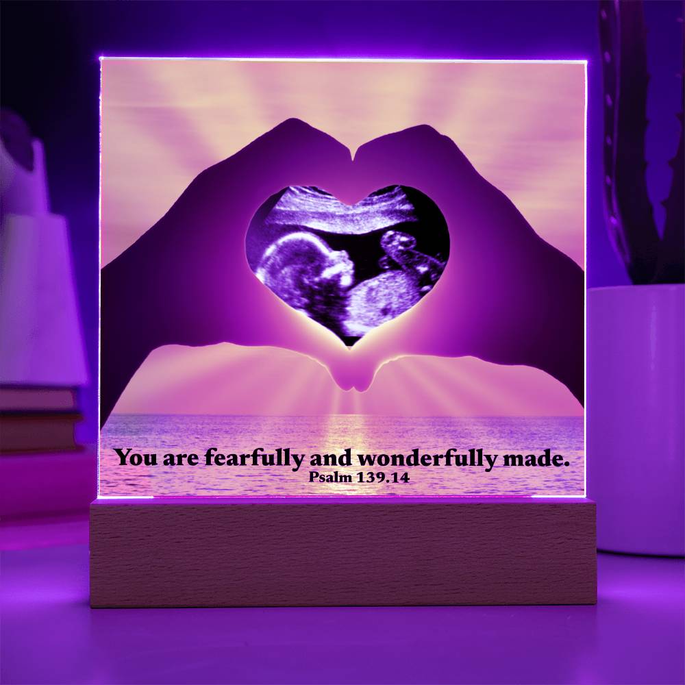 For Mom to Be or Baby| Wonderfully Made Psalm 139.14 Personalized Scan Sonogram Ultrasound Pic | Christian Gift Mother’s Day, Baby Shower, Christmas