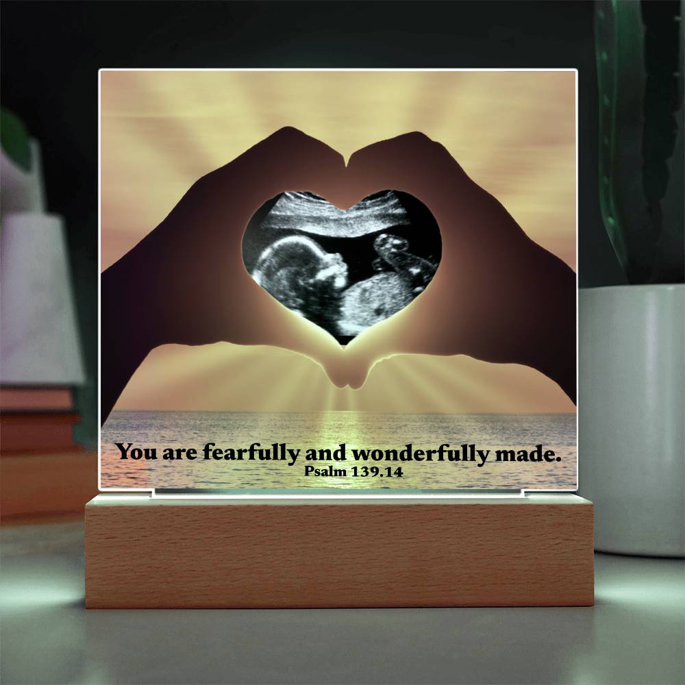 For Mom to Be or Baby| Wonderfully Made Psalm 139.14 Personalized Scan Sonogram Ultrasound Pic | Christian Gift Mother’s Day, Baby Shower, Christmas