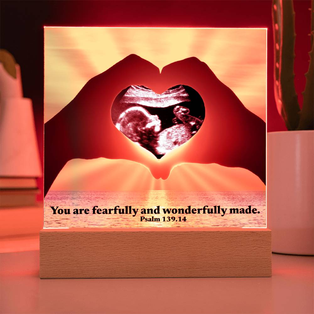 For Mom to Be or Baby| Wonderfully Made Psalm 139.14 Personalized Scan Sonogram Ultrasound Pic | Christian Gift Mother’s Day, Baby Shower, Christmas