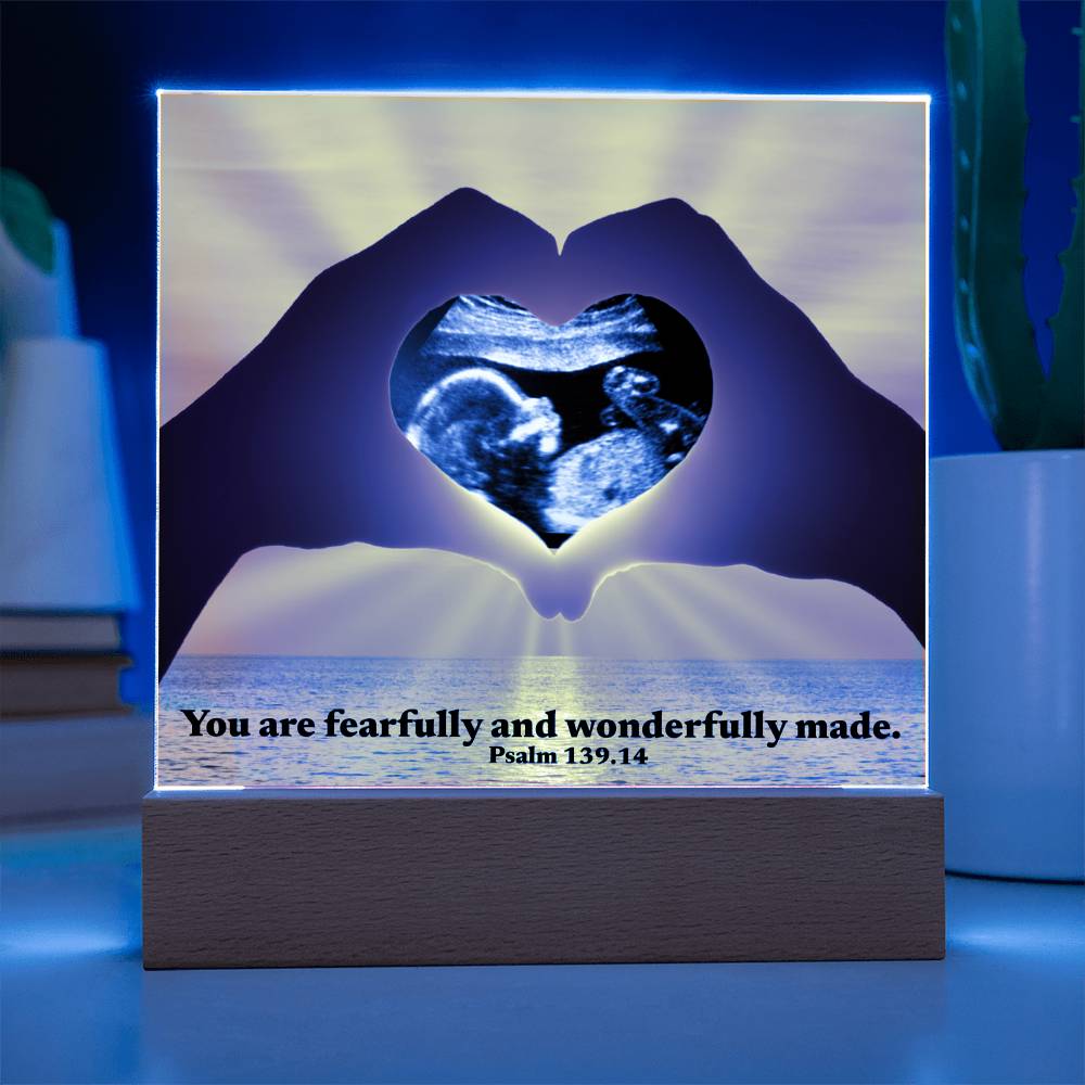 For Mom to Be or Baby| Wonderfully Made Psalm 139.14 Personalized Scan Sonogram Ultrasound Pic | Christian Gift Mother’s Day, Baby Shower, Christmas